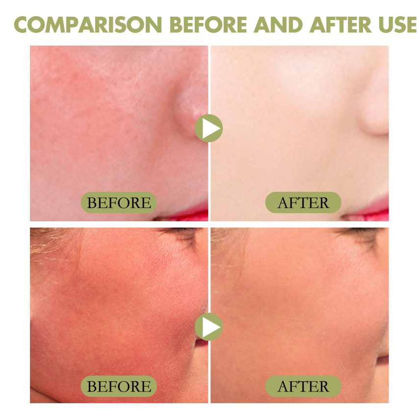 Refreshing Skincare Cream For Summer